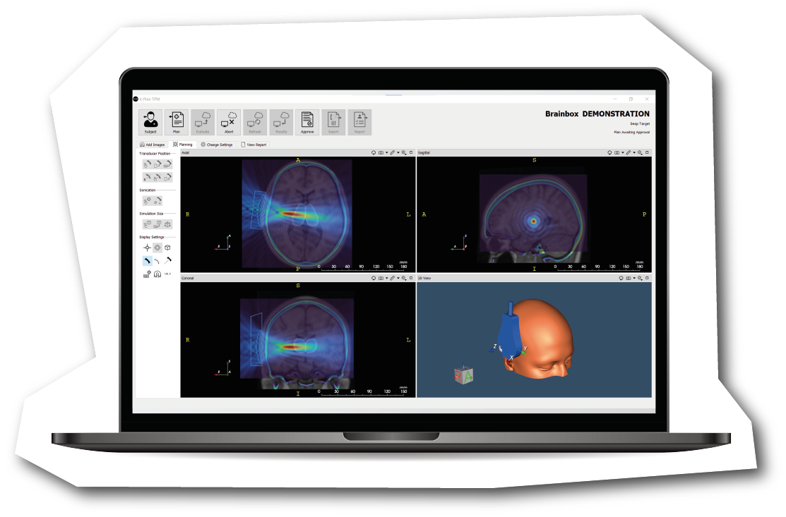 K-Plan Ultrasound Planning | Brainbox